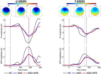 Auditory Mismatch Negativity in Youth Affected by Autism Spectrum Disorder With and Without Attenuated Psychosis Syndrome